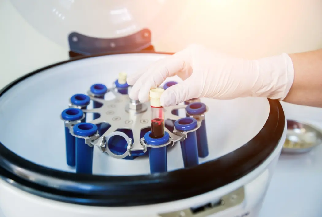 Jak dobrać wirówkę laboratoryjną w zależności od zastosowania?