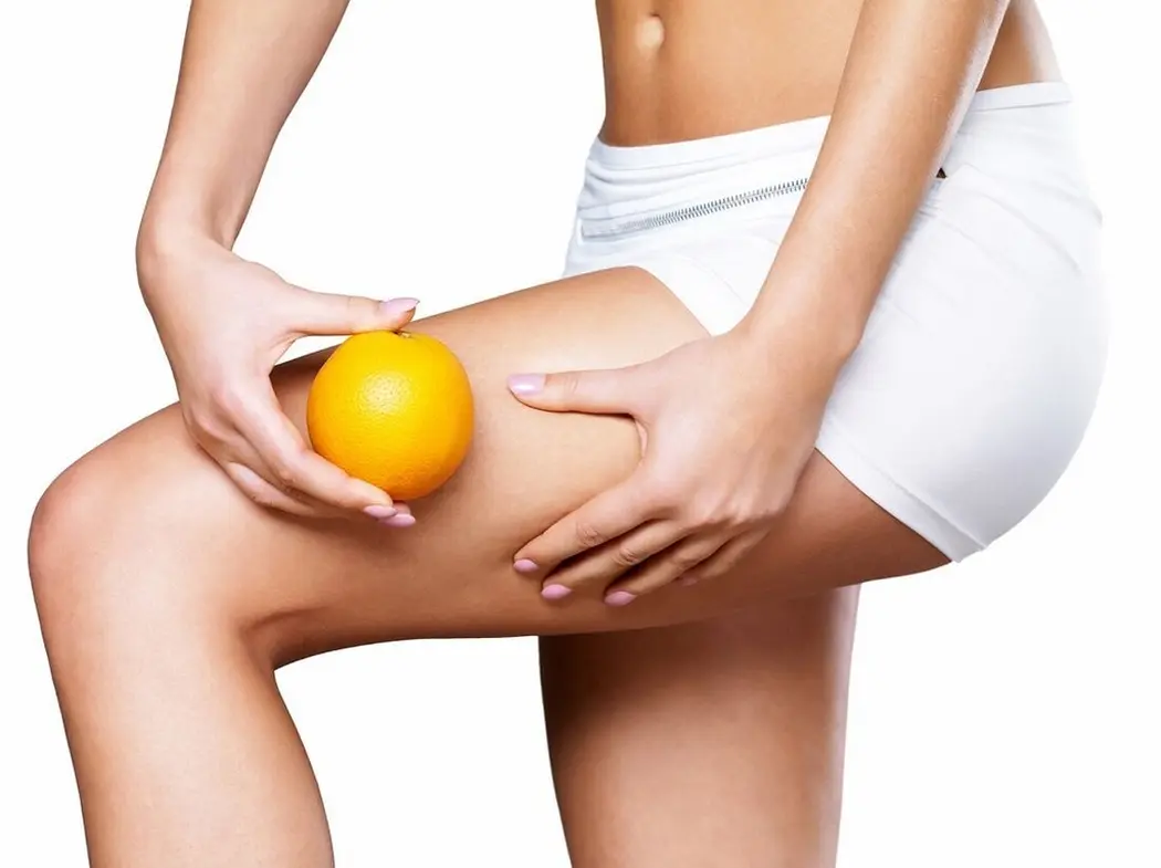 Czym jest cellulit i jak sobie z nim radzić: sposoby na pozbycie się "pomarańczowej skórki"